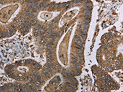 MRGPRX1 Antibody