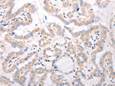 CIDEB Antibody