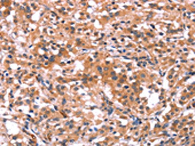 BCR Antibody