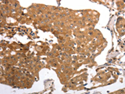 MMP27 Antibody