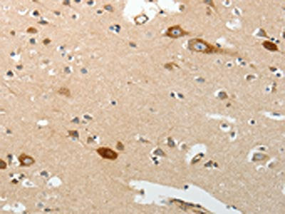 SREBF2 Antibody