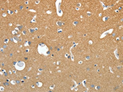 SSTR4 Antibody