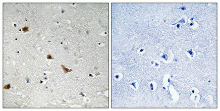 Phospho-IKBKG (Ser376) Antibody
