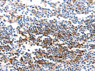 GJB6 Antibody