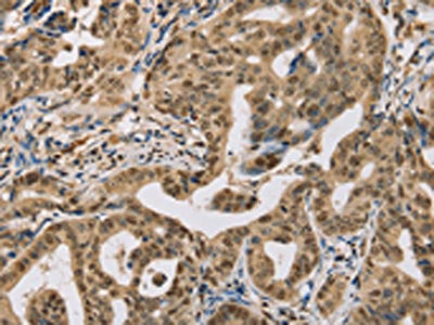 CENPV Antibody