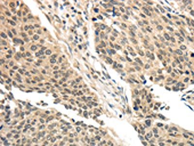 BRCA2 Antibody