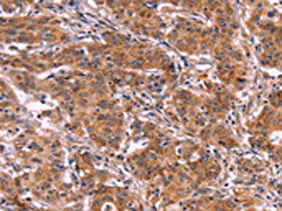 MMP14 Antibody