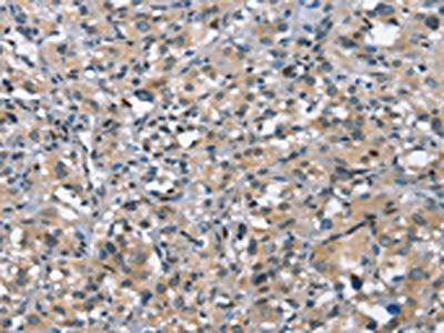 DDR2 Antibody