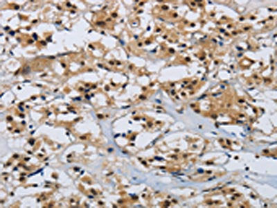 CMTM8 Antibody