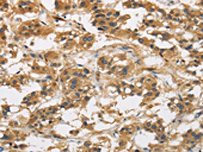 GAS7 Antibody