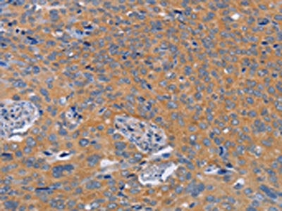 BOD1 Antibody