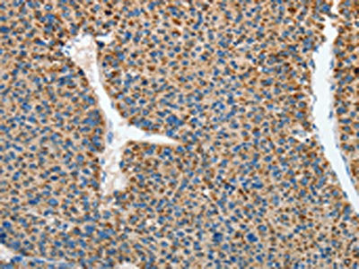 RCAN1 Antibody
