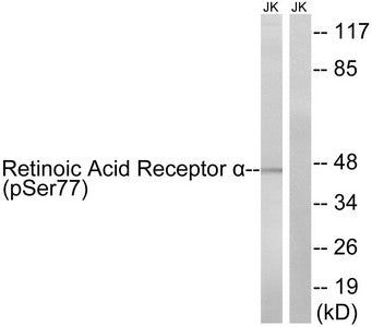 Phospho-RARA (Ser77) Antibody