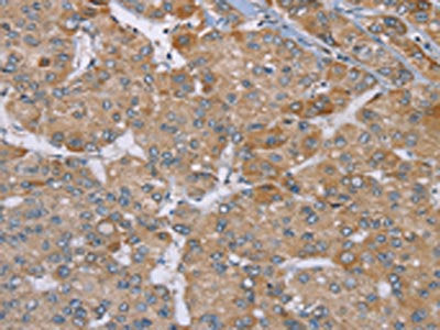 ACTN2 Antibody