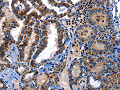 STAT5A Antibody