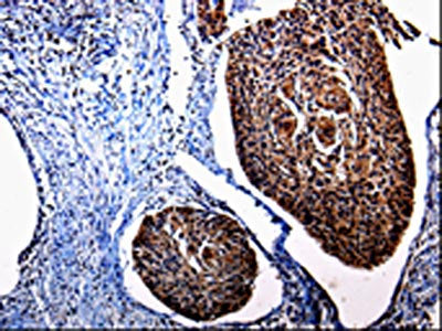 KLK3 Antibody
