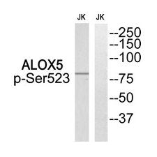 Phospho-ALOX5 (Ser523) Antibody
