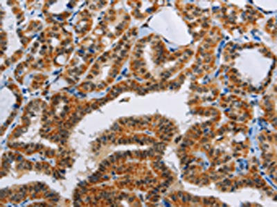 ACVR1B Antibody