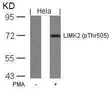 Phospho-LIMK2 (Thr505) Antibody