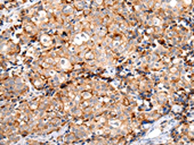 MUC1 Antibody