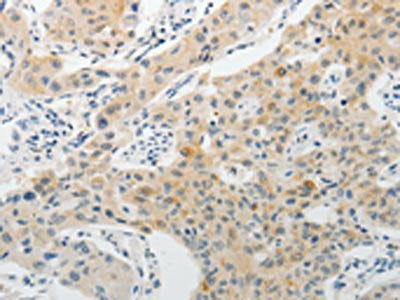 PADI4 Antibody