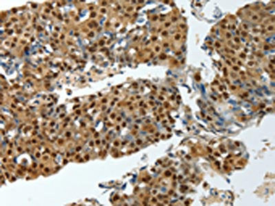 YBX1 Antibody