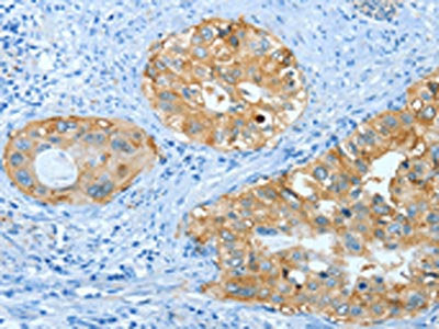ANXA3 Antibody