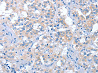 IRAK3 Antibody