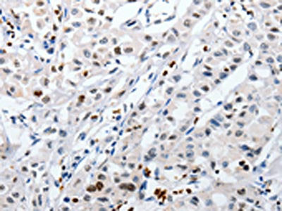 HSPA1A Antibody