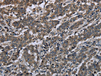 MAPKAPK2 Antibody