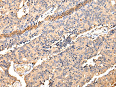 SDCBP Antibody