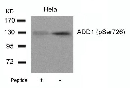 Phospho-ADD1 (Ser726) Antibody