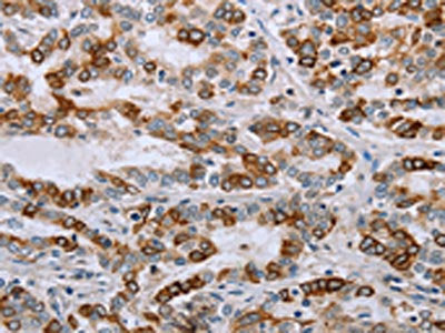 NMT1 Antibody
