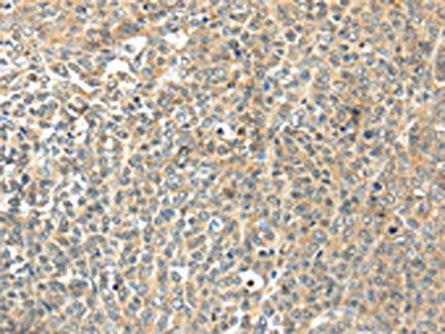 TSPYL6 Antibody