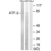 ATF2 (Ab-472) Antibody