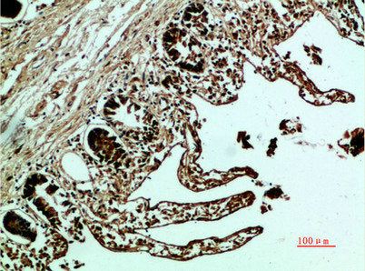 FN1 Antibody