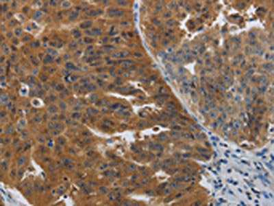 PDCD2 Antibody