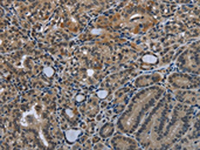 GDF3 Antibody
