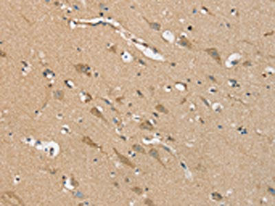 NES Antibody