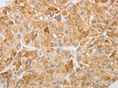 NGF Antibody