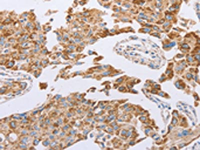 GUCY1A3 Antibody