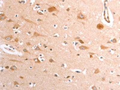 TRPV4 Antibody