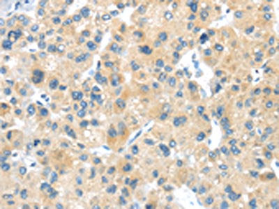 LPAR1 Antibody