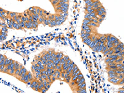 GRM1 Antibody