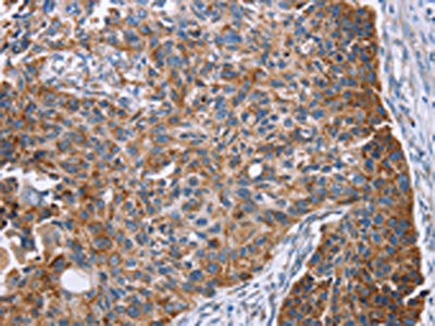 PMPCB Antibody