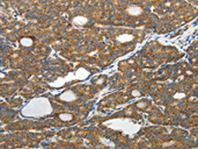 SLC12A4 Antibody