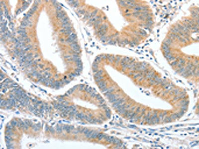 CKAP2 Antibody