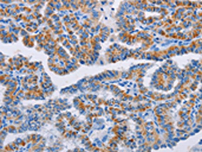 BCL2A1 Antibody
