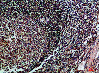HLA-DMB Antibody