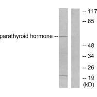 PTH Antibody